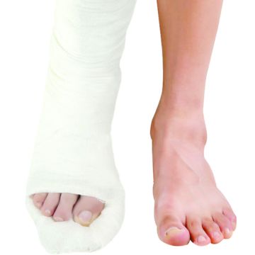 Dyna (Top Cast) Plaster of Paris Bandage B. P - 2.7m- 12's Pack