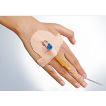 Dyna Easy Fix Cannula Fixator (NST)- 100's Pack